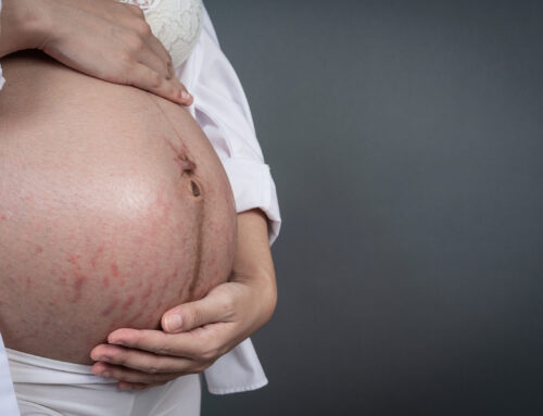 Em 10 anos, casos de sífilis congênita crescem 63% no RN